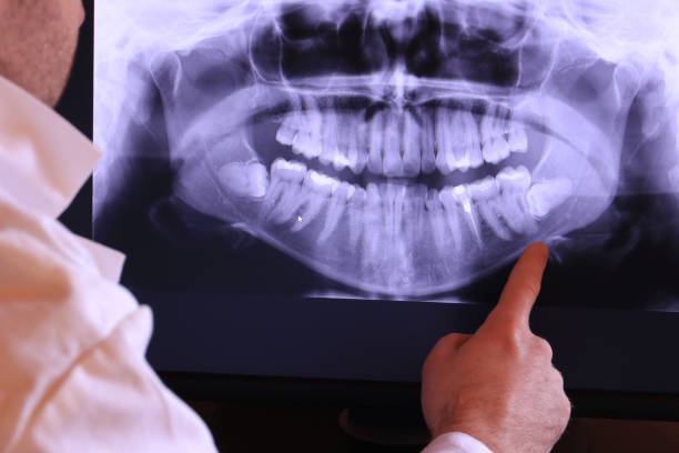 Best Orthodontic Emergency Dentist in Roanoke, IN