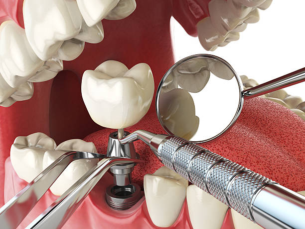 Best Weekend Emergency Dentist in Roanoke, IN