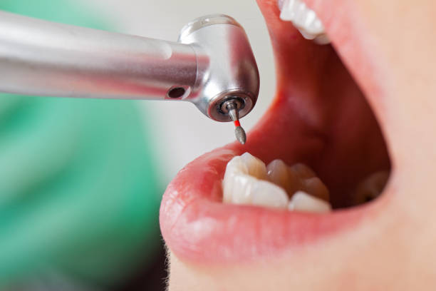 Best Emergency Cosmetic Dentistry in Roanoke, IN